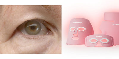 Red Light Therapy for Droopy Eyelids