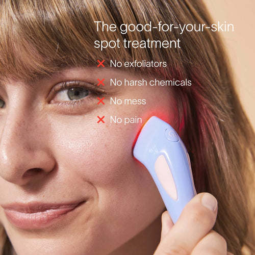 A user applies the blue Bye Acne Pro Kit device by SolaWave on their cheek, utilizing light therapy. The message highlights: The good-for-your-skin spot treatment with assurances of No exfoliators, No harsh chemicals, No mess, No pain, for gentle and effective blemish management. || Periwinkle