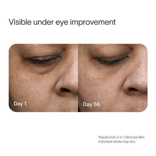 Side-by-side images display skin improvement over time. Left: Day 1 with visible under-eye lines. Right: Day 56 with smoother skin, using SolaWaves 2-in-1 Face & Body Mini Starter Kit anti-aging red light therapy. Individual results may vary.