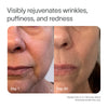 Two facial photos show the lower half of a womans face. Day 1 exhibits wrinkles and redness, while Day 30, after using the Solawave 4-in-1 Red Light Therapy Wand & Activating Serum Kit, shows smoother, clearer skin. Text: Visibly rejuvenates wrinkles, puffiness, and redness.