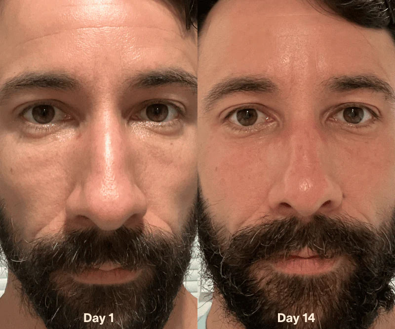 Solawave Red Light Therapy Wand Microcurrent Before After Men